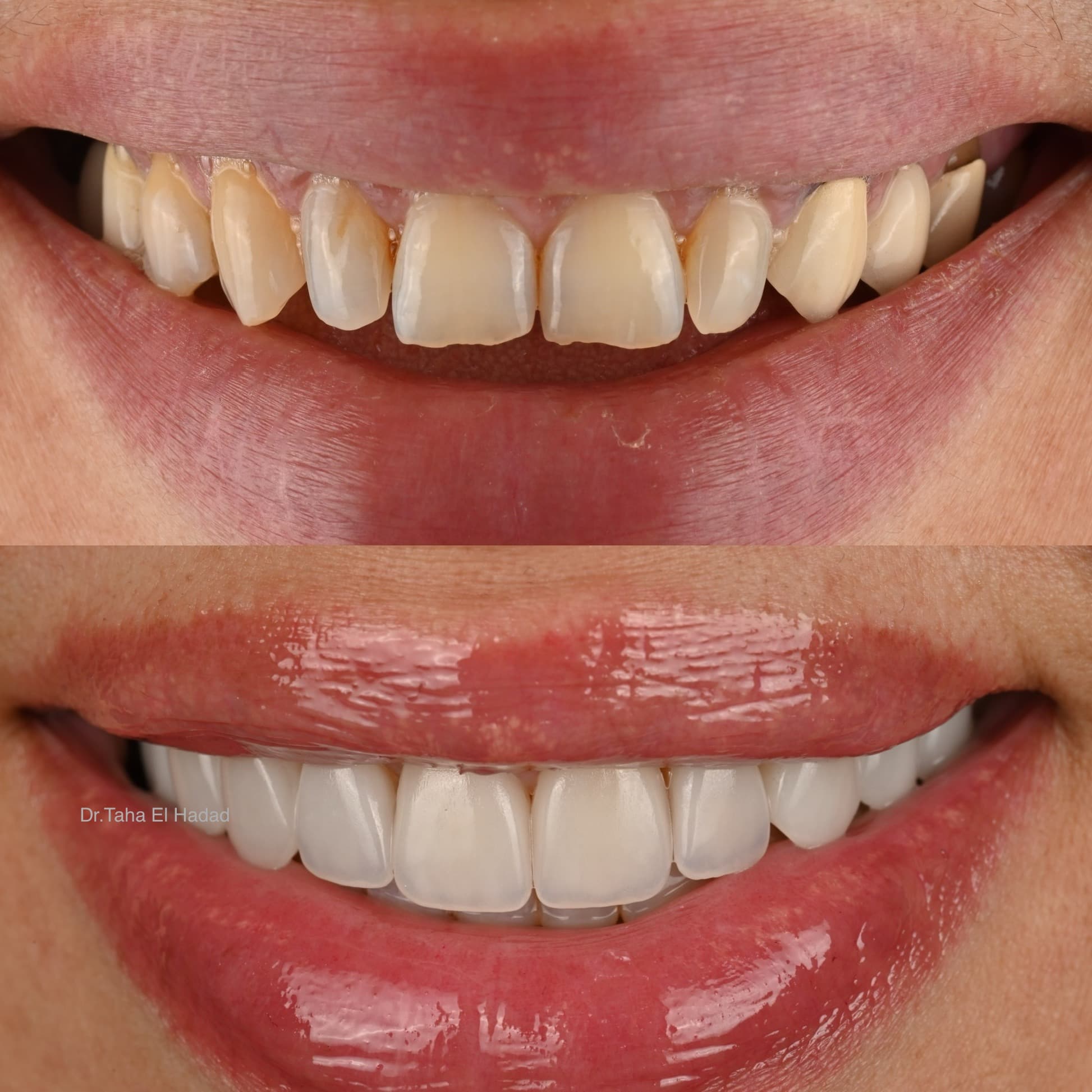 Soins dentaires pour enfant au cabinet Master Smile Clinic a Casablanca