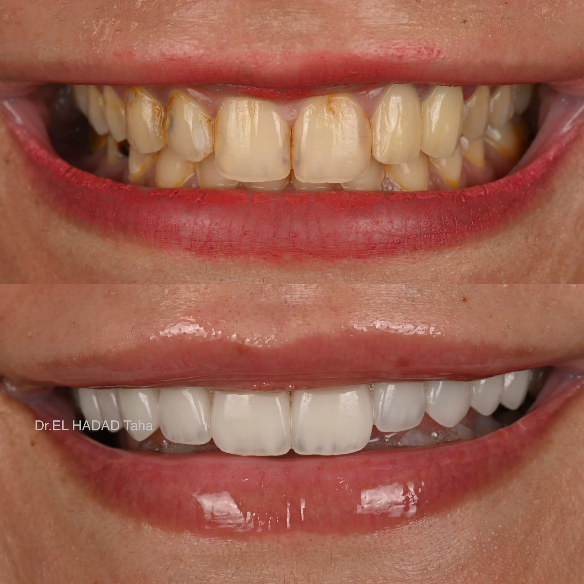 Dentiste pour enfant, visite au cabinet Master Smile Clinic a Casablanca